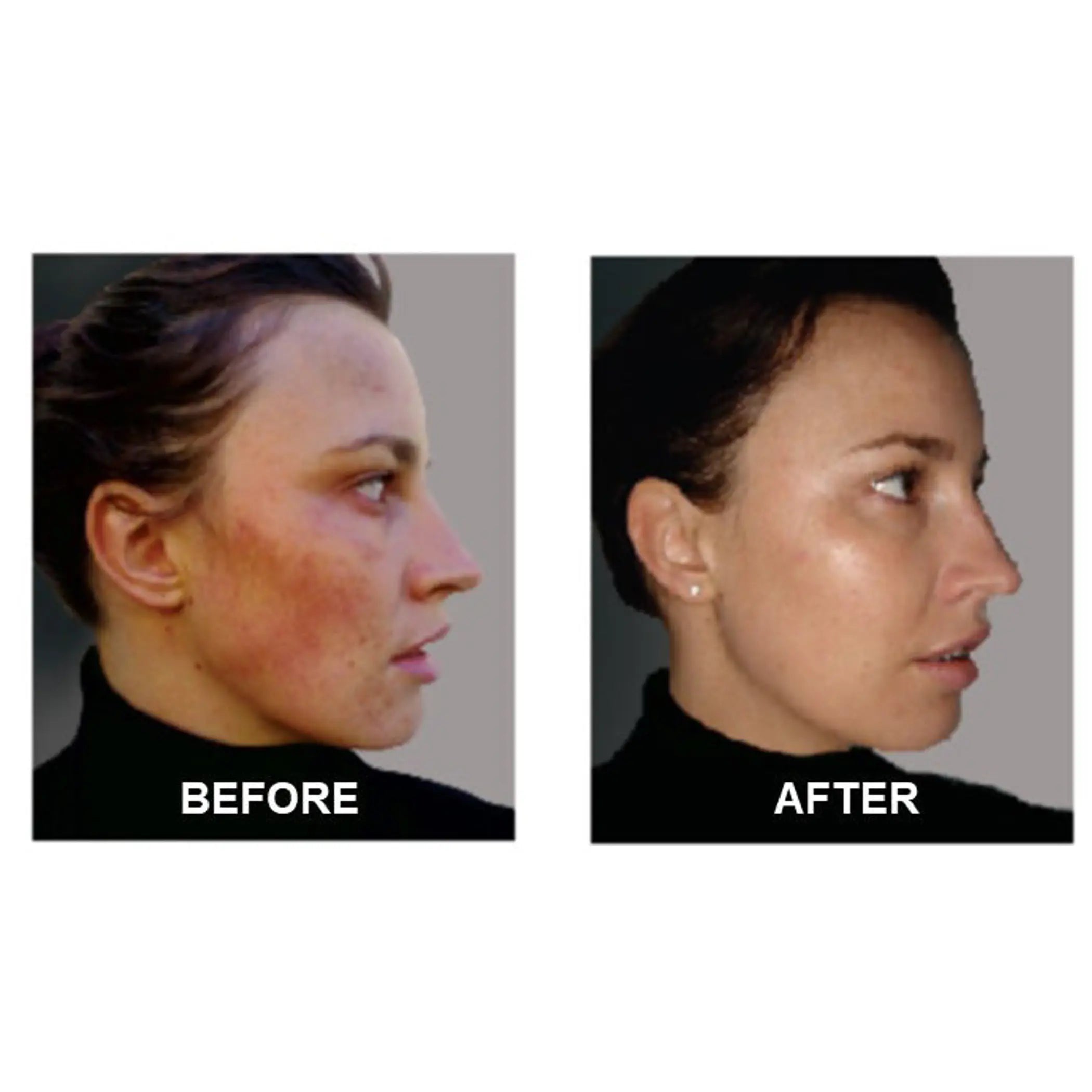 Derm #1 Two Step Regimen DermOne Health & Wellness