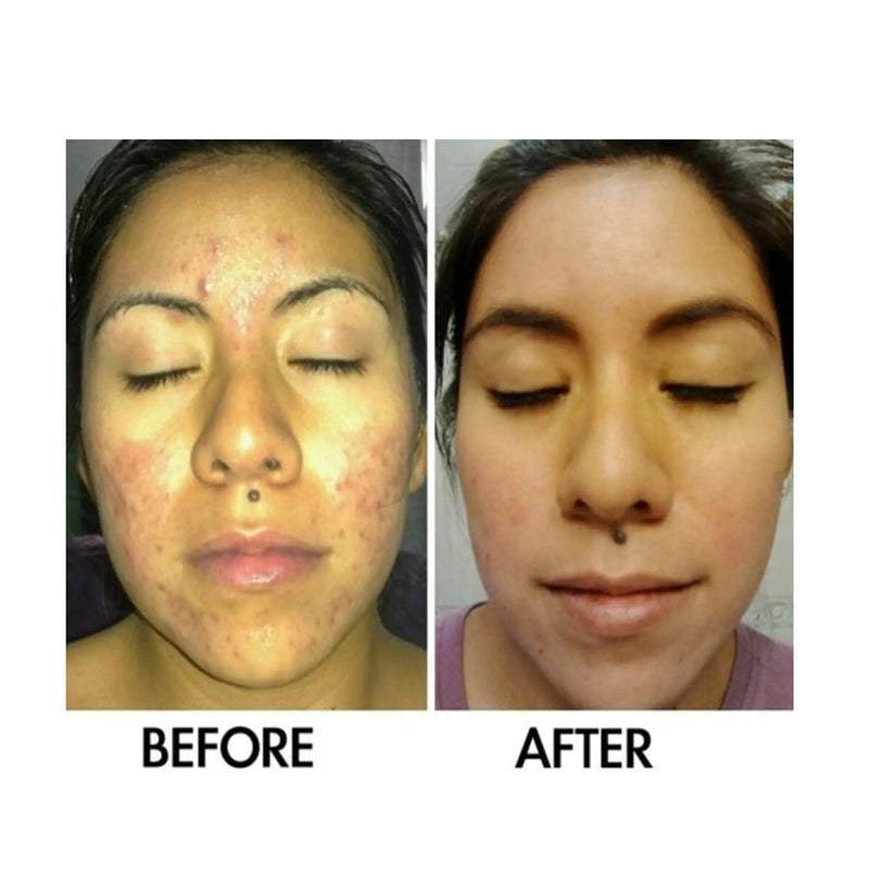Derm #1 Two Step Regimen DermOne Health & Wellness
